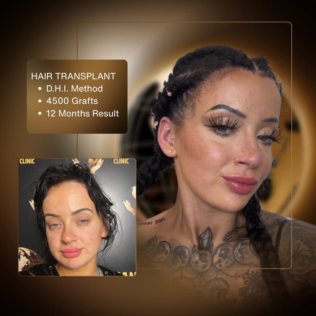 Before & After - D.H.I. 4,500